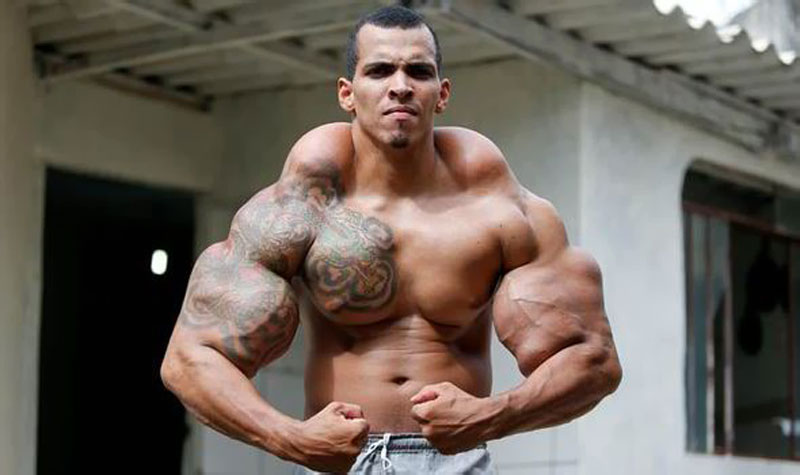 Use of Synthol in Bodybuilding