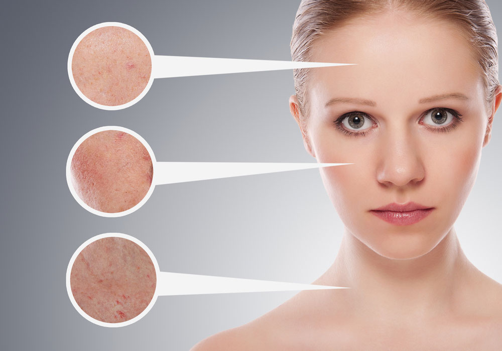 What Are The Skin Problems Commonly Faced In Modern Day Gethow