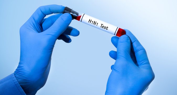How Swine-Flue Test is Clinically Conducted?
