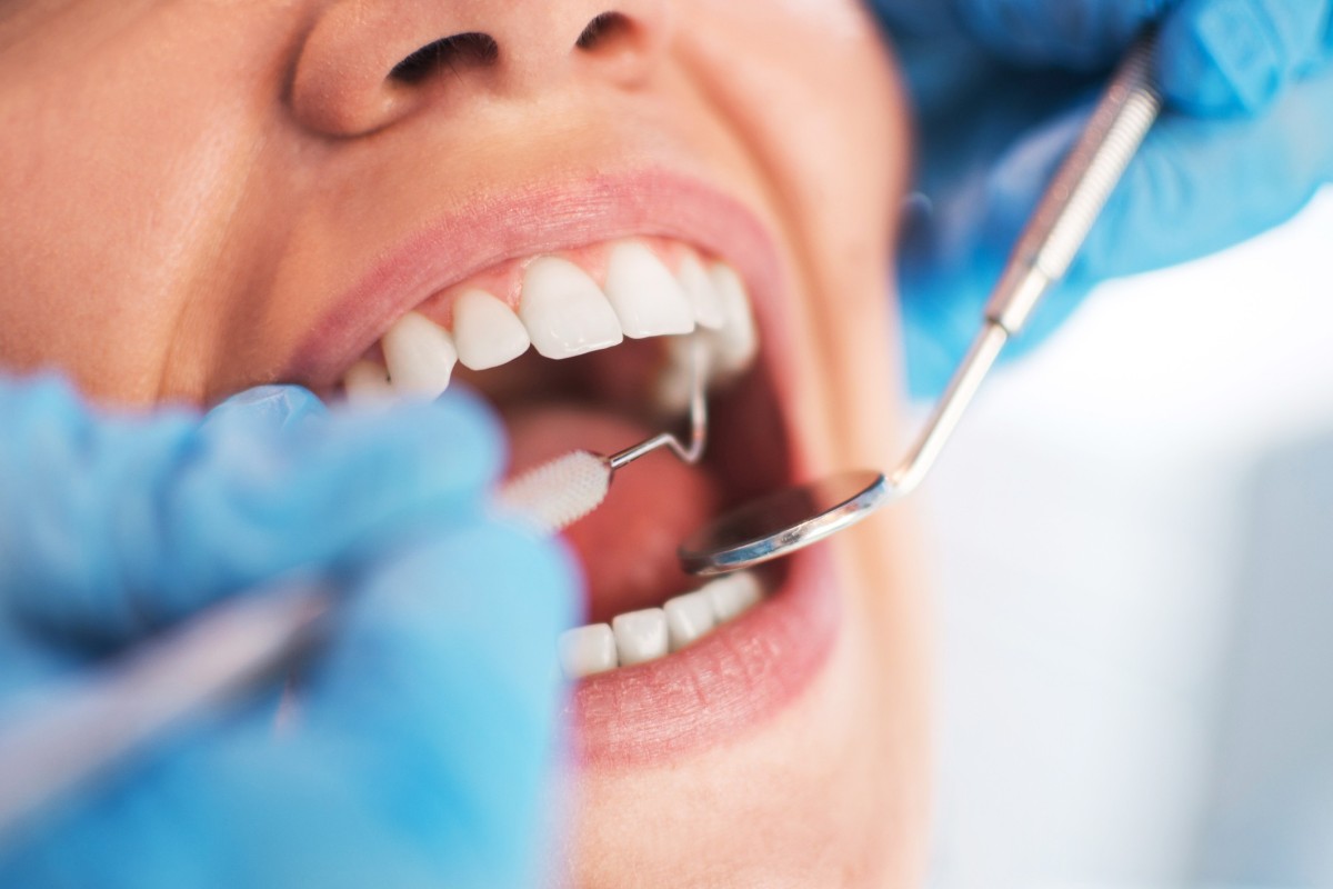 Why You Need to Have Dental Work Done in Naperville IL Before You Retire