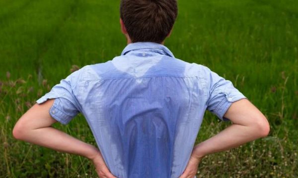 Hyperhidrosis Explained