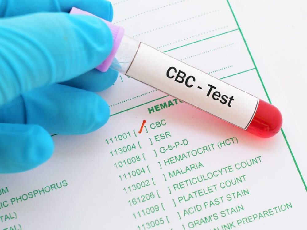 CBC Blood Test