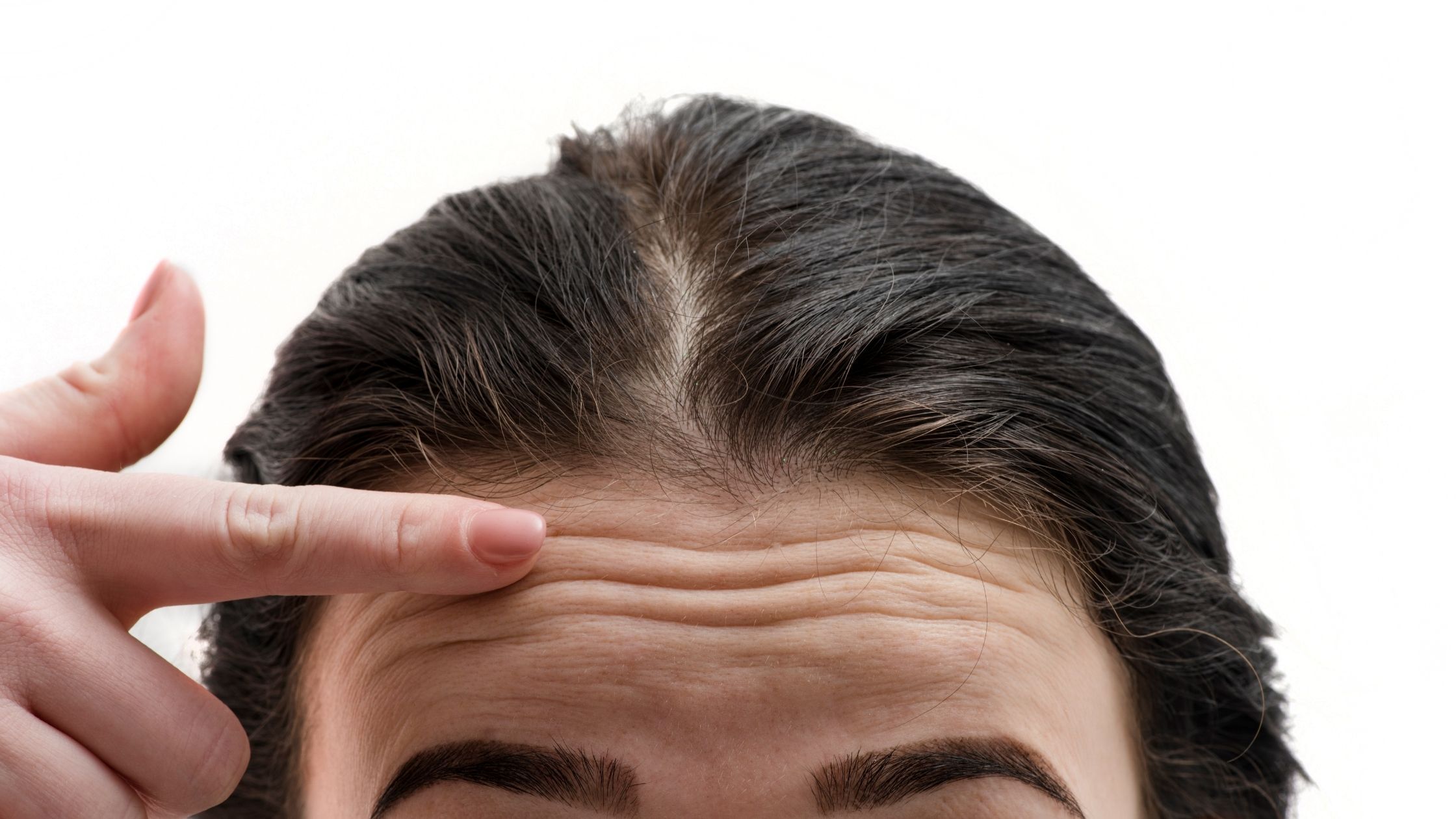 Saggy Eyelid Skin Can Cause Forehead Wrinkles at an Early Age