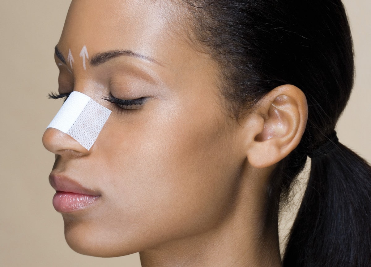 3 Reasons Bad Rhinoplasty Scars Are Unlikely to Happen to You